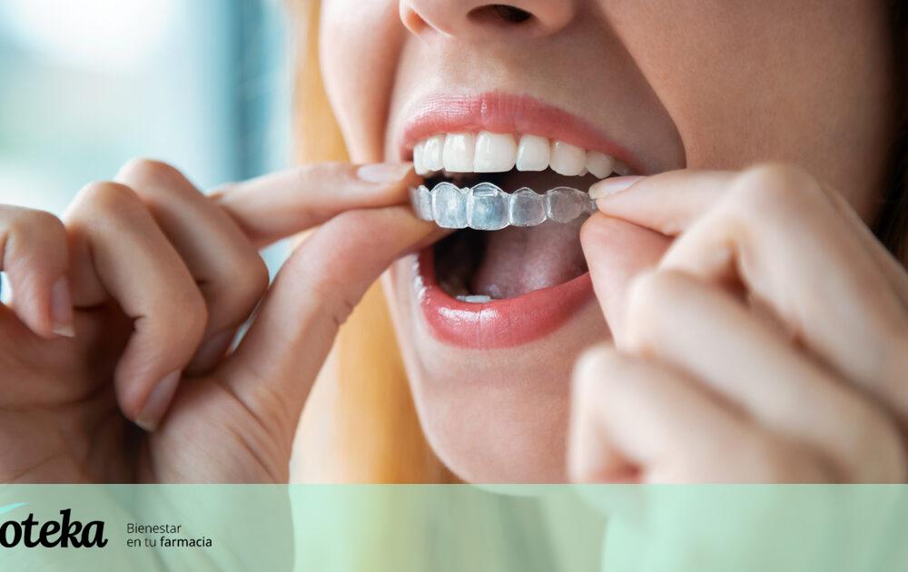 Invisalign: qué es y qué ventajas/desventajas tiene